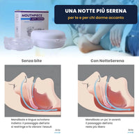 Come agisce il bite sul passaggio dell'aria: senza bite e con NotteSerena